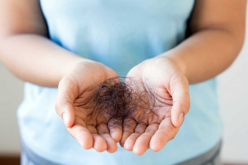 Co značí padání vlasů u žen a jak tomu předejít?